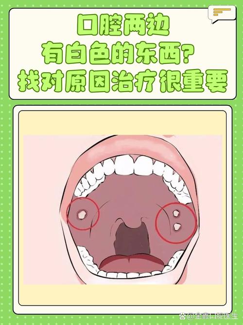 口水粘稠是口腔疾病信号吗?