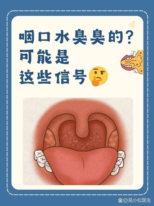 口水粘稠是口腔疾病信号吗?