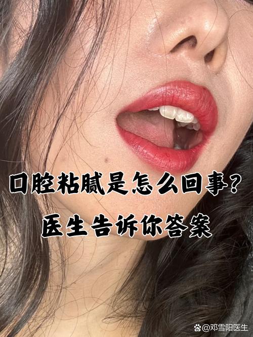 口水粘稠是口腔疾病信号吗?