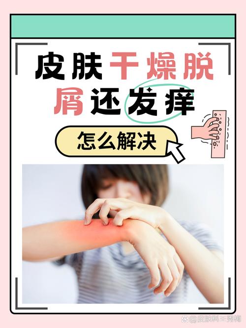 皮肤干燥起静电怎么办