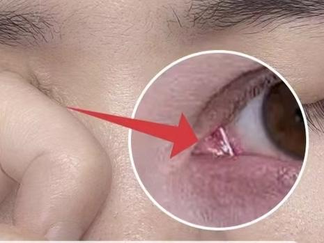 皮肤瘙痒是肝出问题的信号吗?