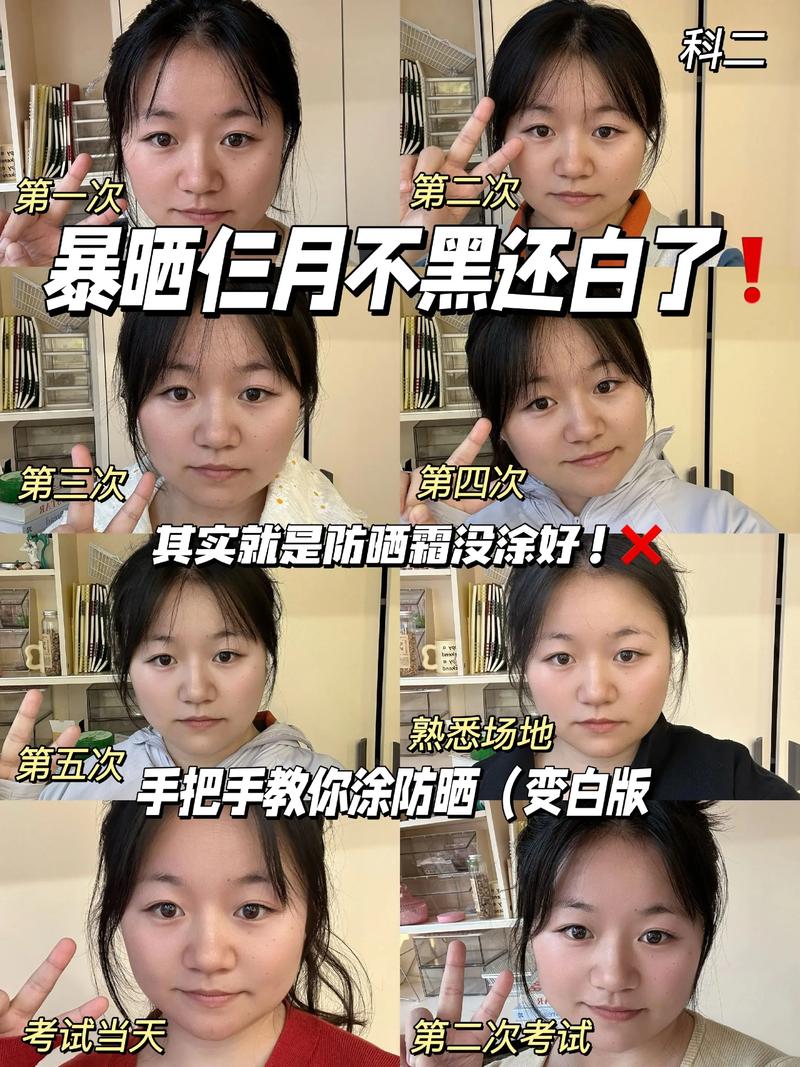 晒伤后的皮肤如何变白