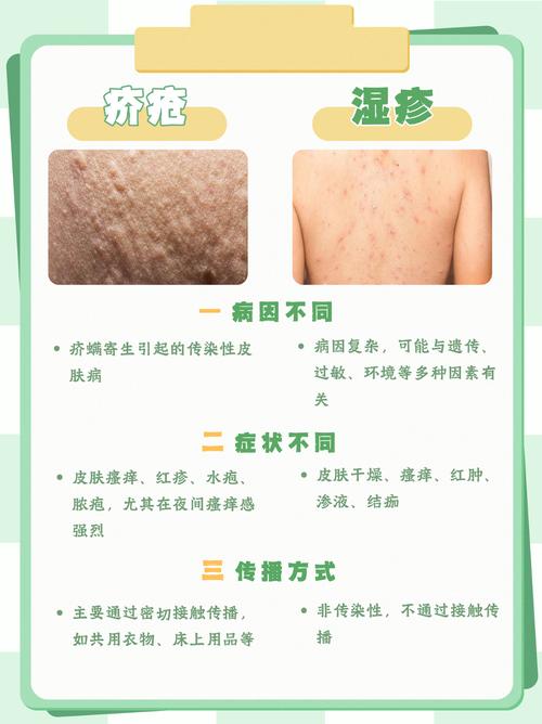 皮肤病疥疮怎么引起的