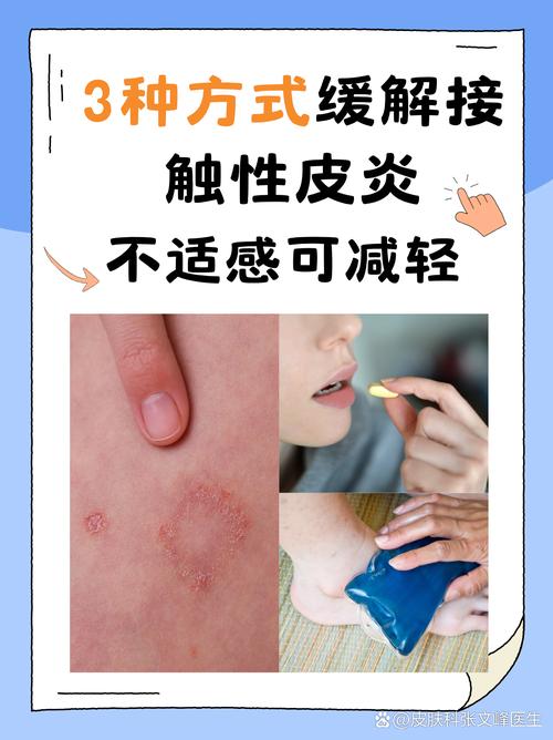 氢氟酸沾皮肤如何紧急处理?