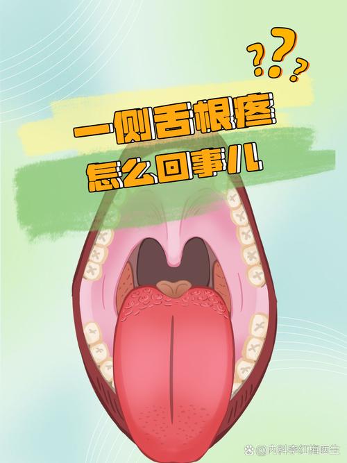 口腔舌头痛是上火还是生病了?