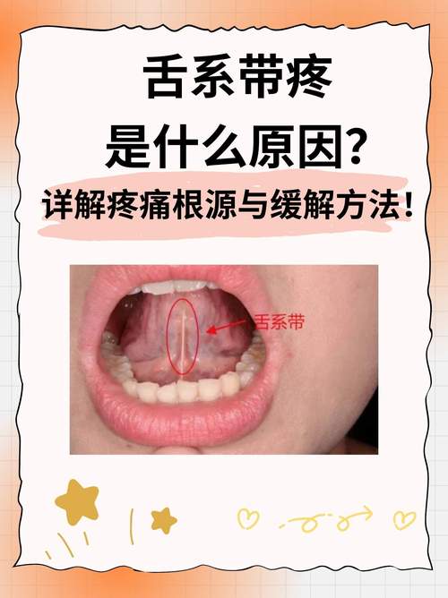 口腔舌头痛是上火还是生病了?