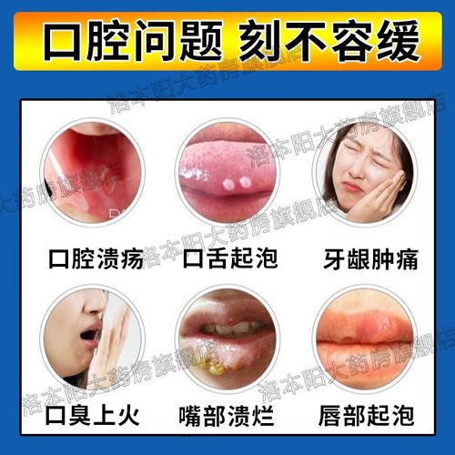 嘴角口腔溃疡怎么治疗