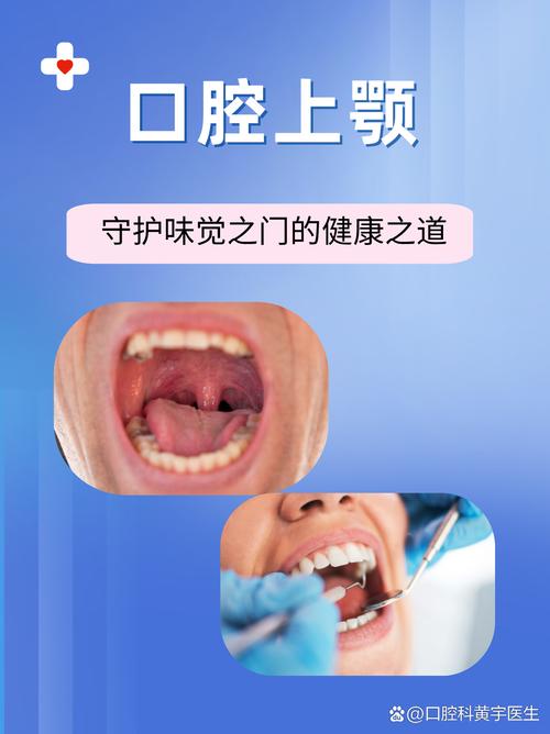 口腔上颚麻是什么原因