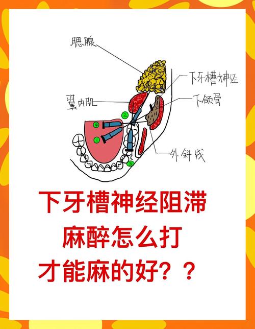 口腔打麻药进针点图有哪些关键位置?