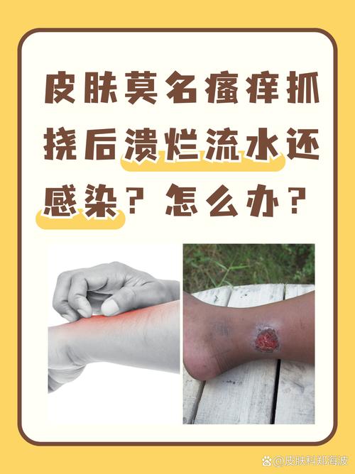 皮肤莫名破损是何病?