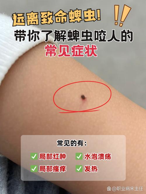 梦见虫子钻进皮肤吸血是何征兆?