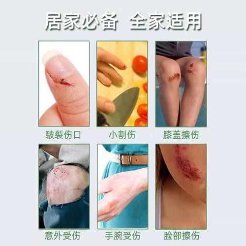 受伤皮肤如何快速恢复?