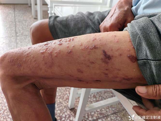 德阳市人民医院皮肤科