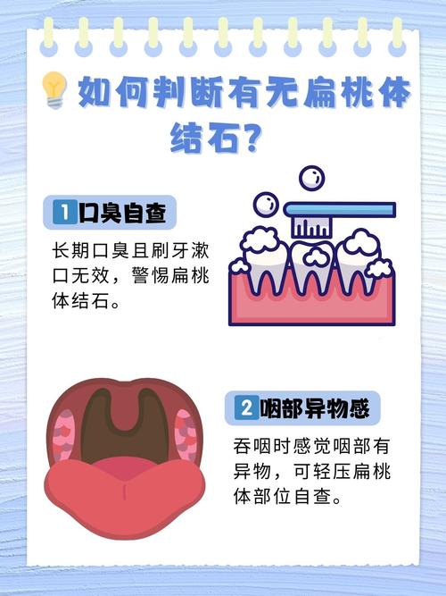 口腔淋巴结石为何引发口臭?