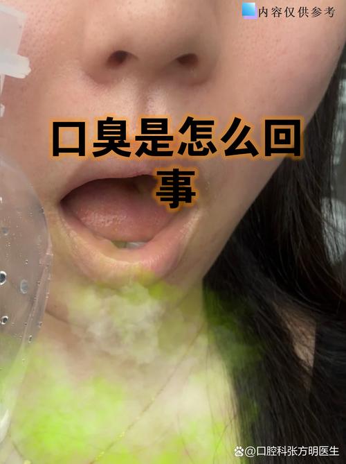 口腔有齿印,是身体发出的求救信号吗?