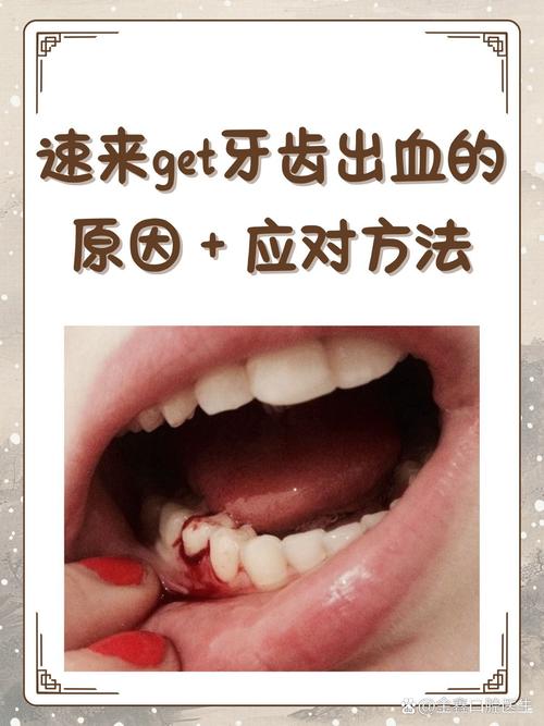 口腔有齿印,是身体发出的求救信号吗?