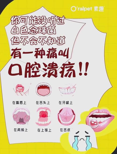 口腔溃疡能吃酸奶吗?