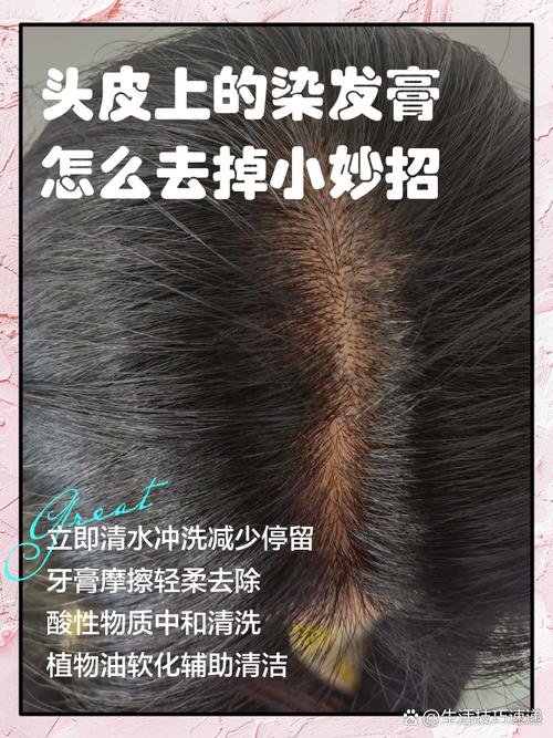 染头膏沾皮肤上怎么快速清理干净?