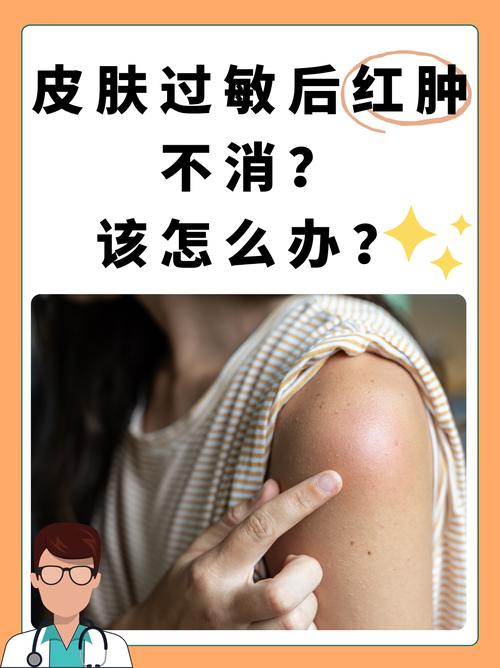 皮肤过敏几天能好?影响因素有哪些?