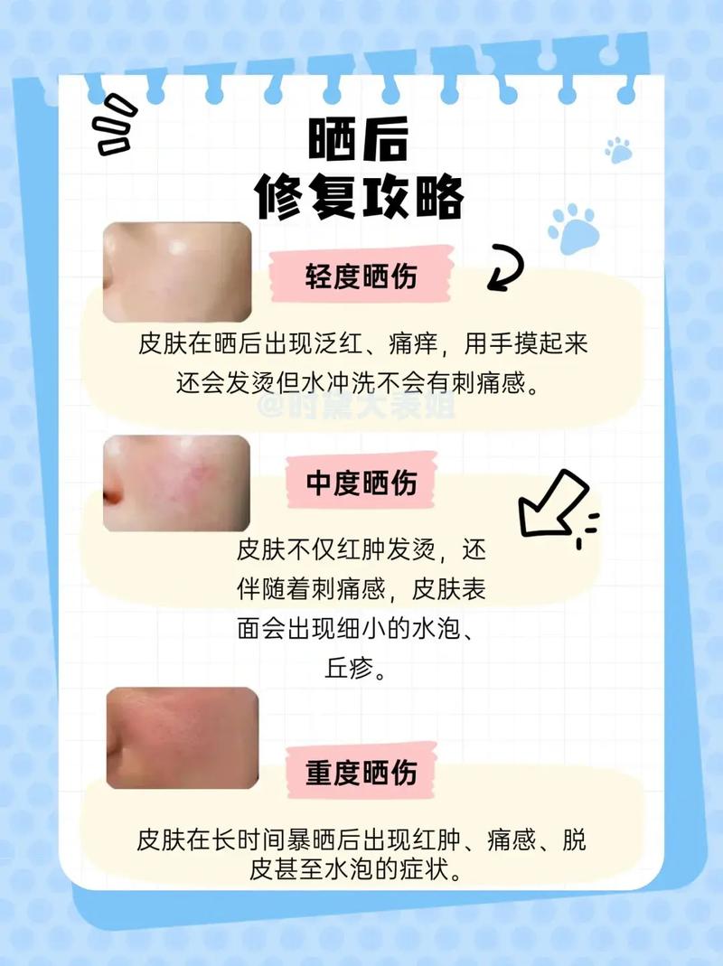 太阳晒伤皮肤痒,怎么快速缓解止痒?