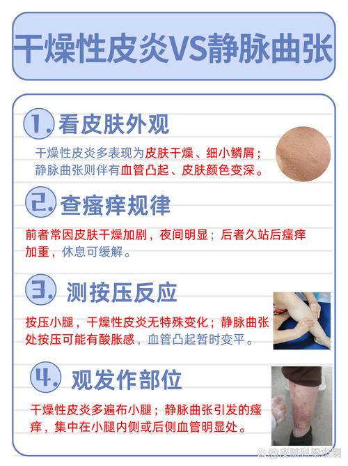 水土不服皮肤痒,如何快速缓解?