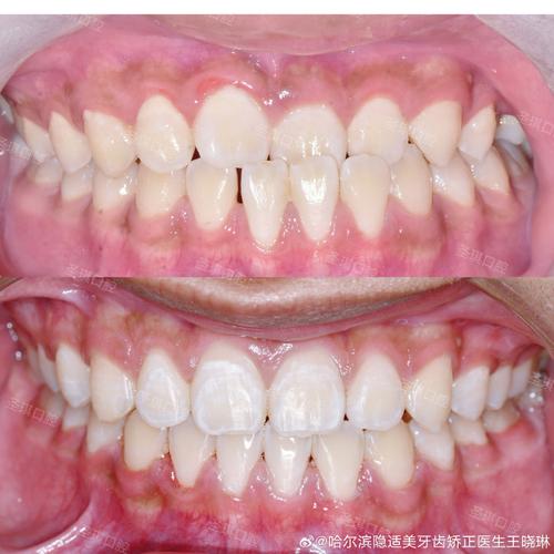 哈尔滨圣琪口腔是否存在黑幕?