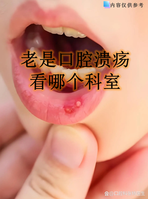 老是口腔溃疡看什么科