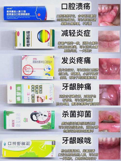 老是口腔溃疡看什么科