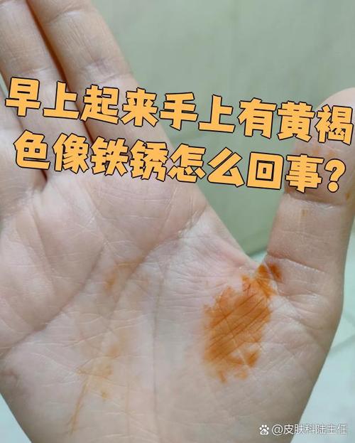 手上皮肤发黄,是何原因所致?