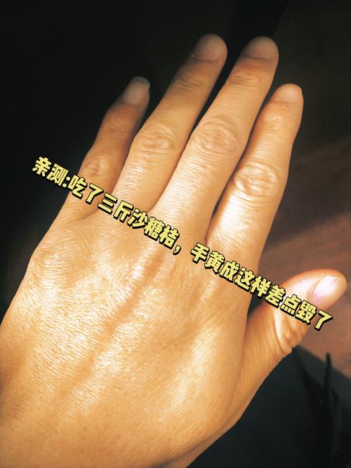 手上皮肤发黄,是何原因所致?