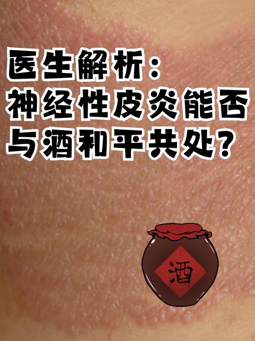 喝酒后皮肤痒是酒精过敏还是其他原因?