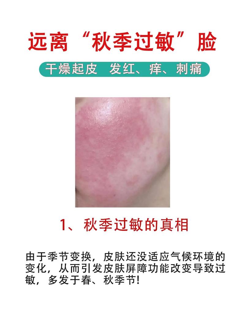 秋换季皮肤痒,该如何快速缓解?