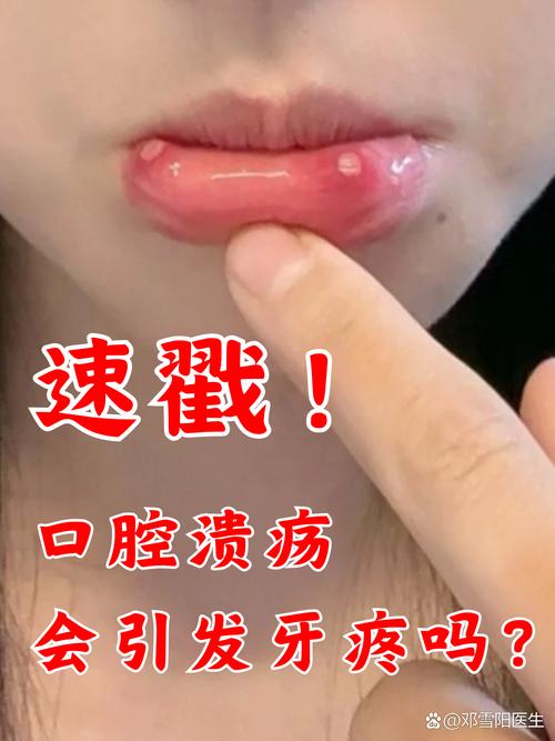 口腔溃疡会引发牙疼吗?