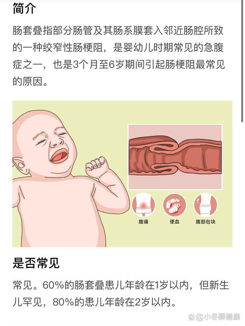 一岁婴儿吐食物,是消化问题还是喂养不当?
