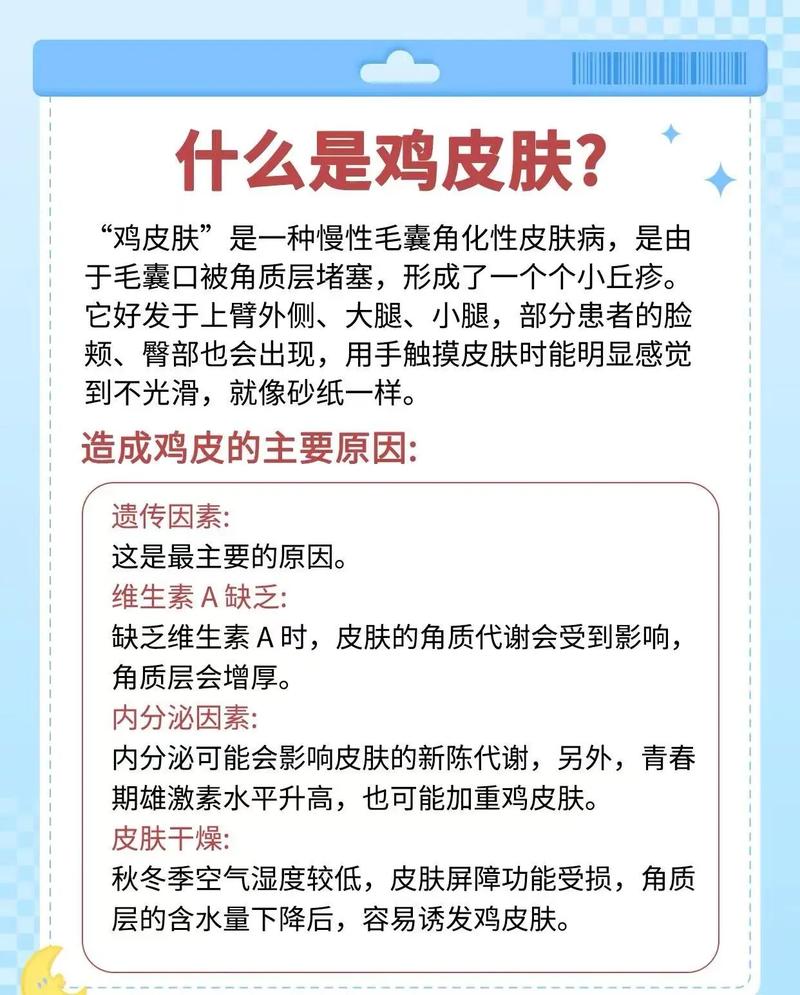 遗传性鸡皮肤怎么治疗