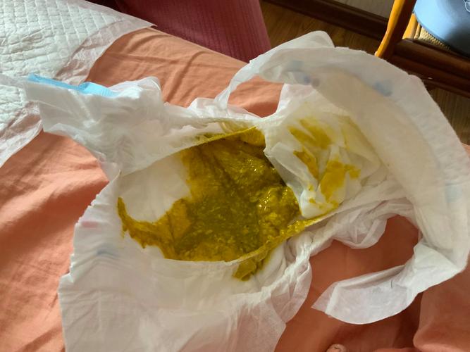 哺乳期食物中毒能吃什么药?