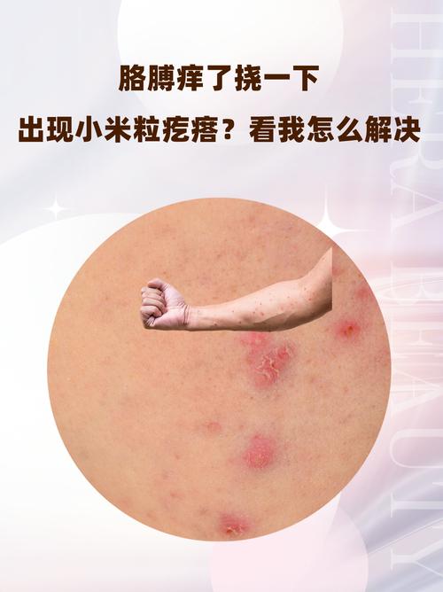 皮肤起痒疙瘩怎么办?