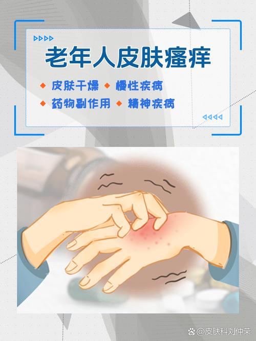 老年人皮肤瘙痒的绝招是什么?