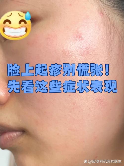 脸上皮肤发红怎么回事