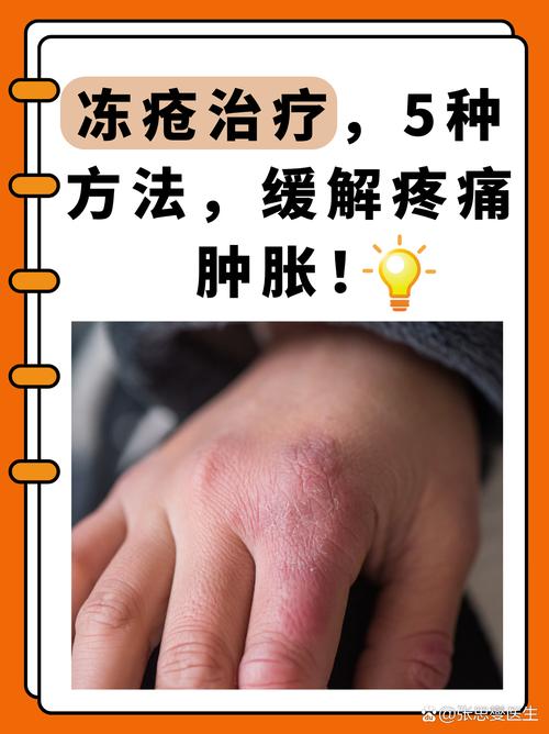 温泉真能治皮肤病吗?