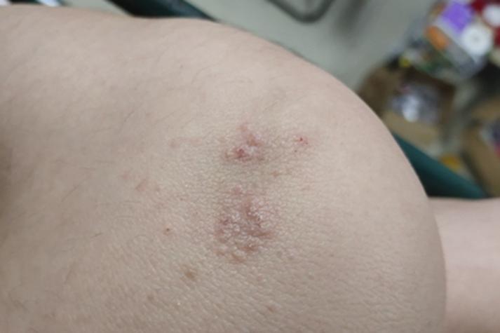 膝盖皮肤粗糙有颗粒感