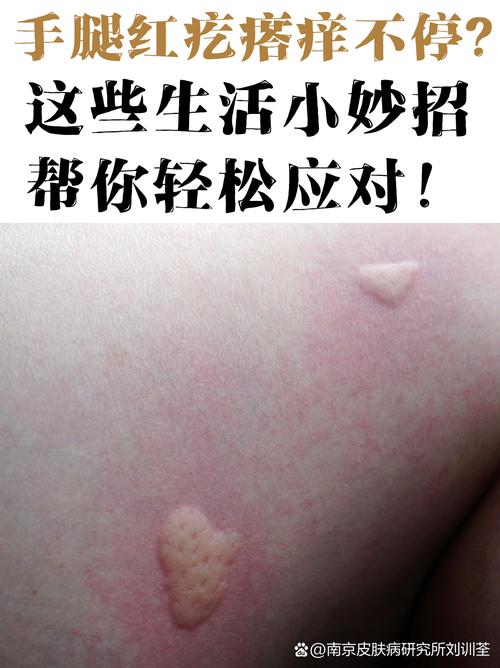 皮肤过敏元凶究竟是什么?