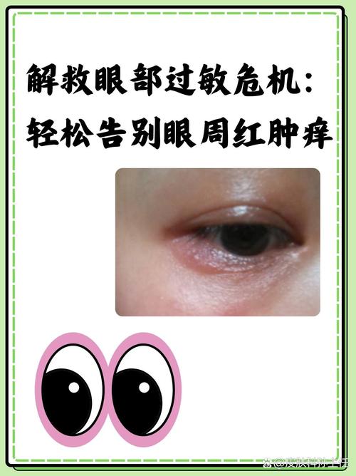 易过敏皮肤如何科学护理?