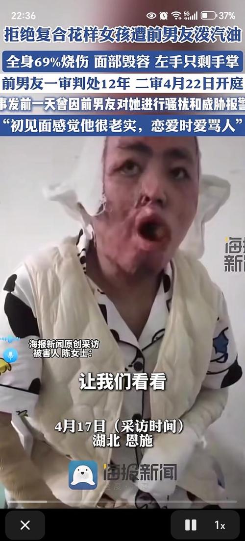 汽油沾皮肤了,咋快速处理?