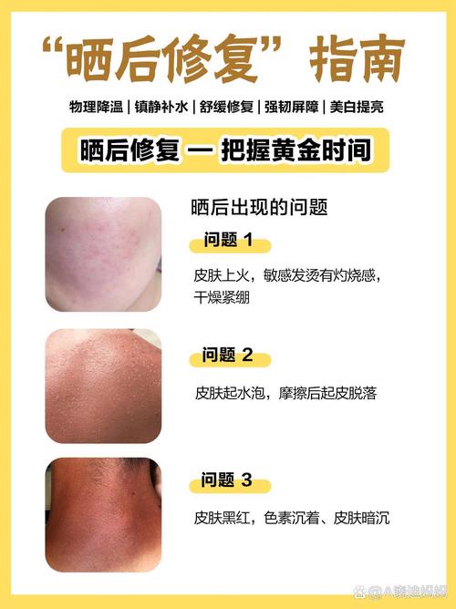 晒伤后皮肤多久能恢复?