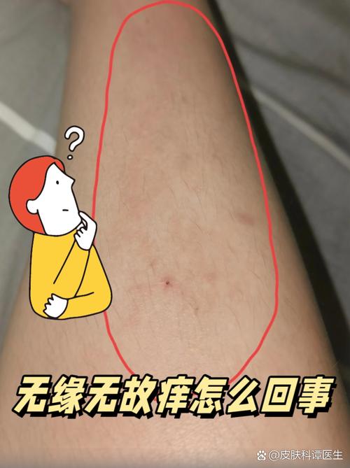 皮肤对称痒是何原因?