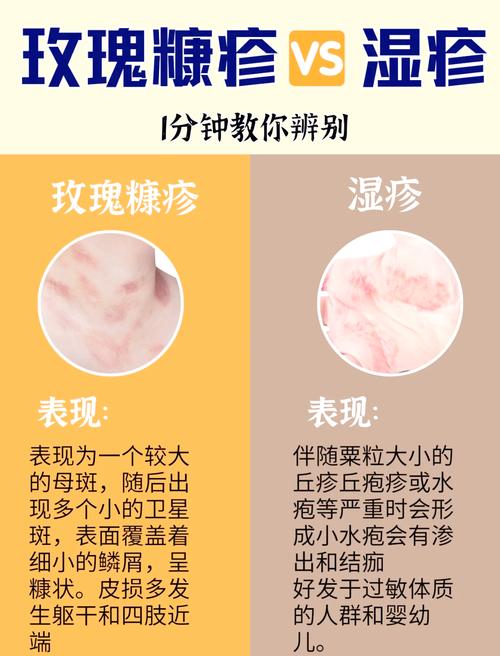 皮肤对称痒是何原因?