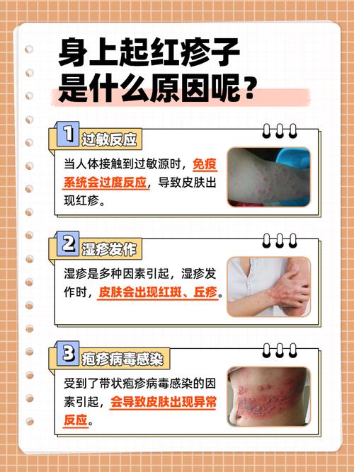 皮肤过敏是身体缺什么?关键营养素缺失?