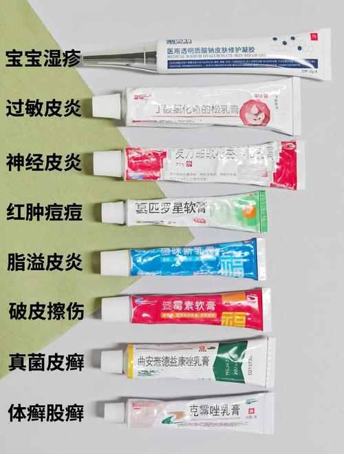 湿疹过敏用药,哪种药最有效且安全?