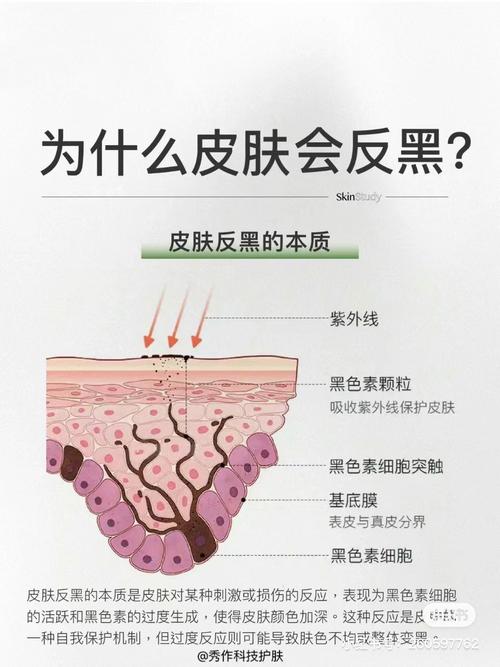 熬夜真的会让皮肤变黑吗？